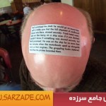 ده راه برای جلوگیری از ریزش مو(طنز)