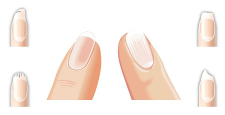 تقویت ناخن شکننده